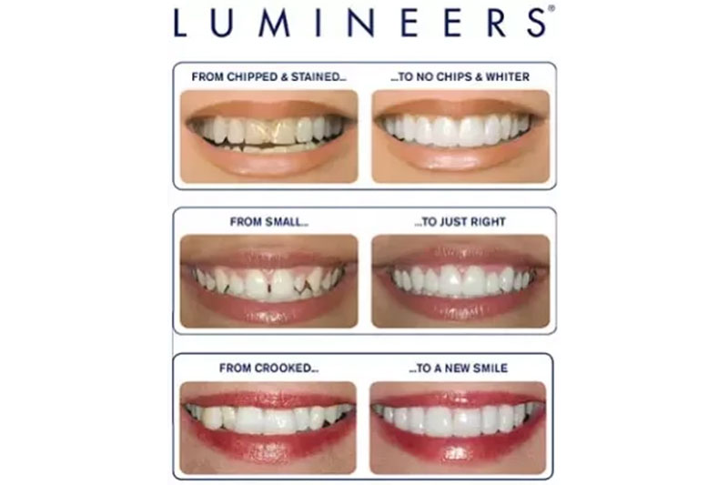 Lumineers in Milford