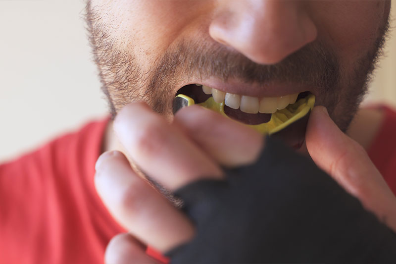 Mouthguards in Milford